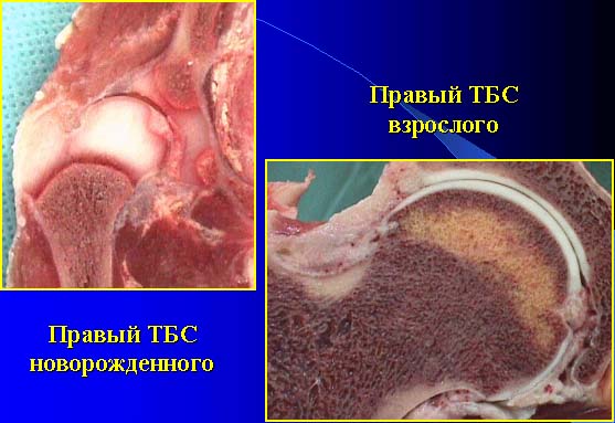 Тазобедренный сустав анатомия строение фото