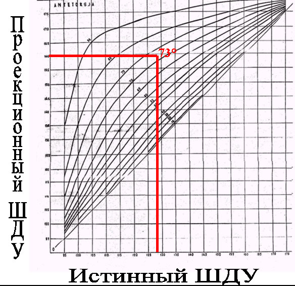 Угол антеторсии тазобедренного сустава thumbnail